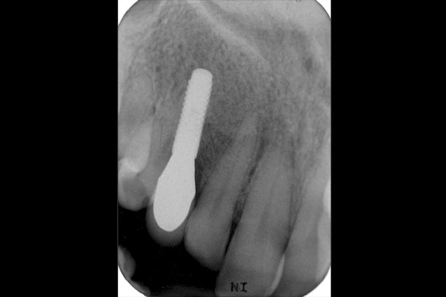 fig. 21