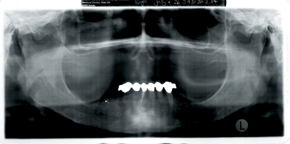 fig. 12