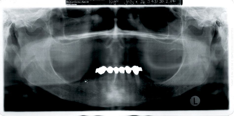 fig. 12