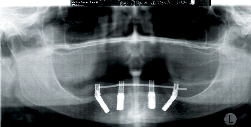fig. 20
