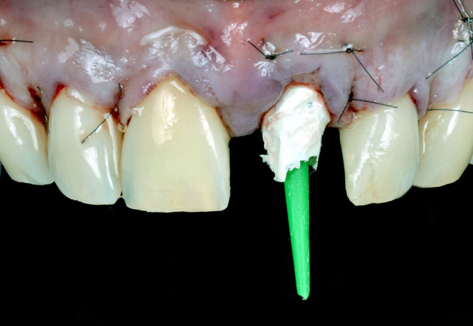 fig. 13