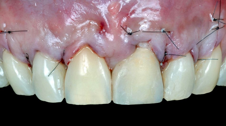 fig. 15