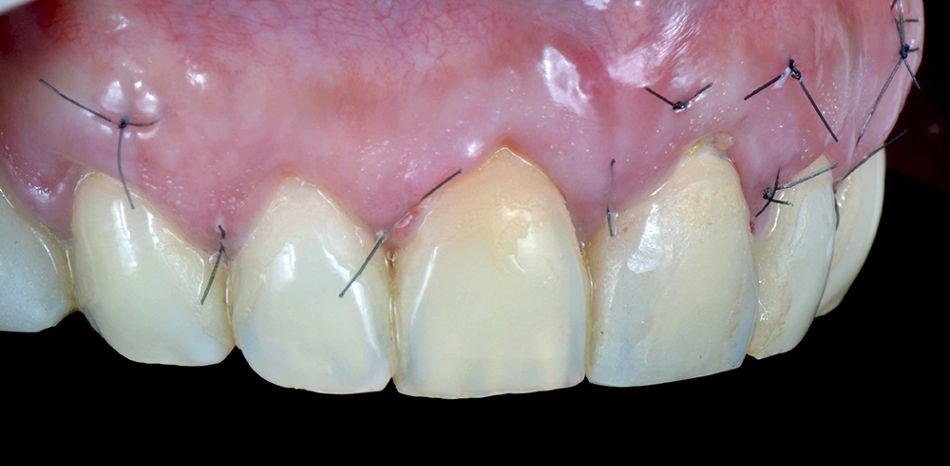 fig. 16