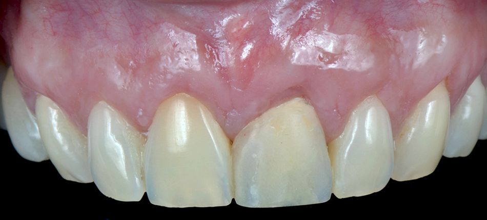 fig. 17
