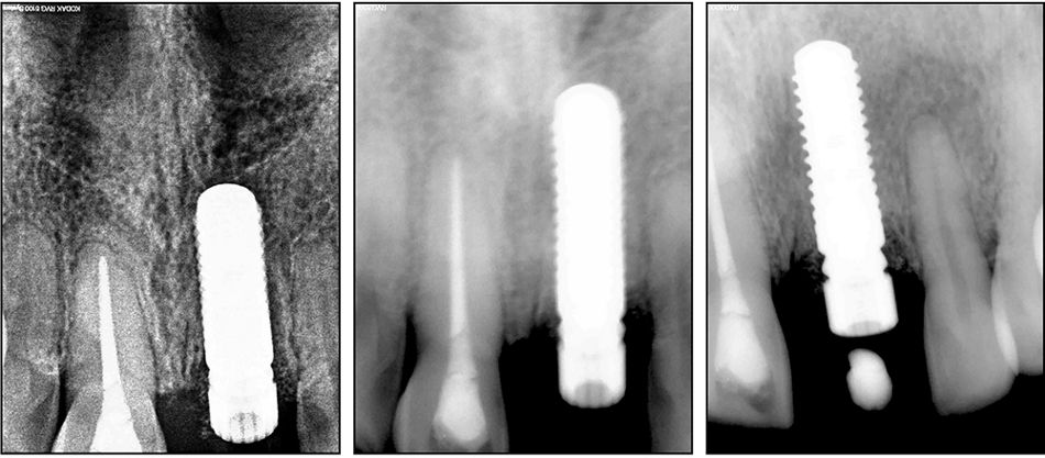 fig. 24