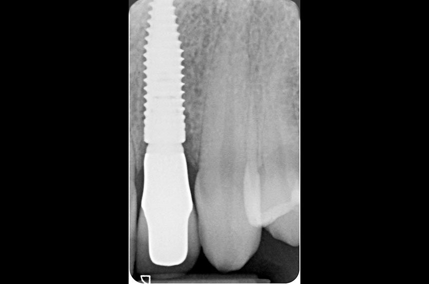 fig. 11
