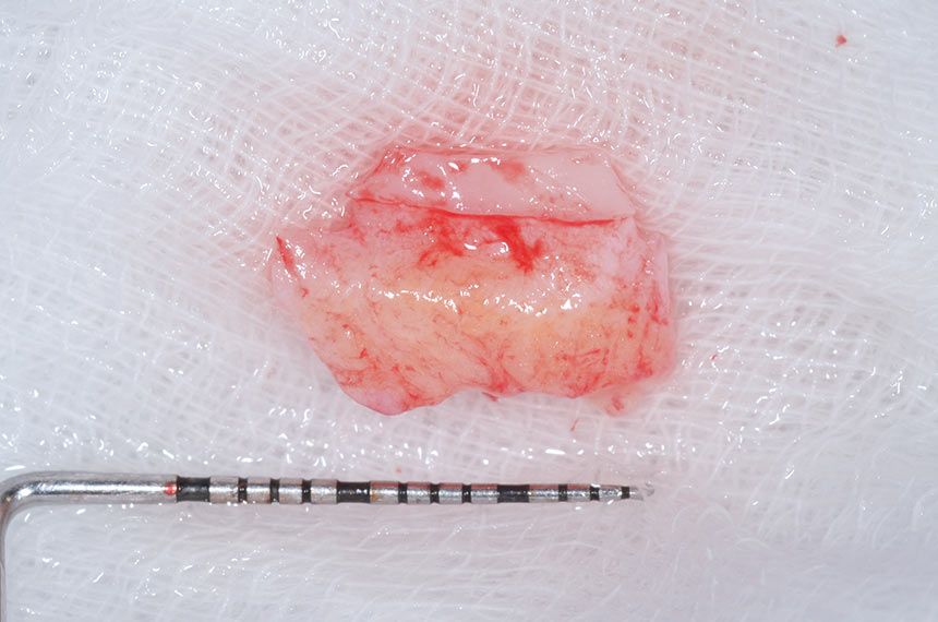 fig. 12