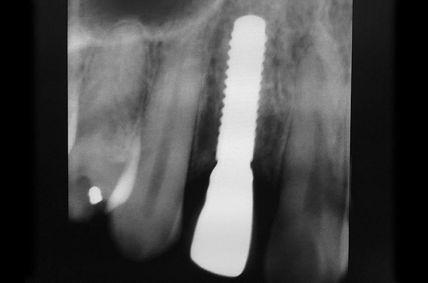 fig. 20