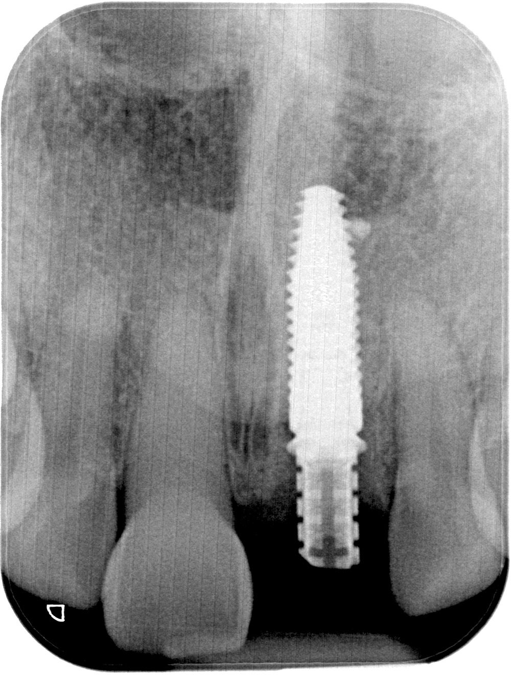 fig. 8a