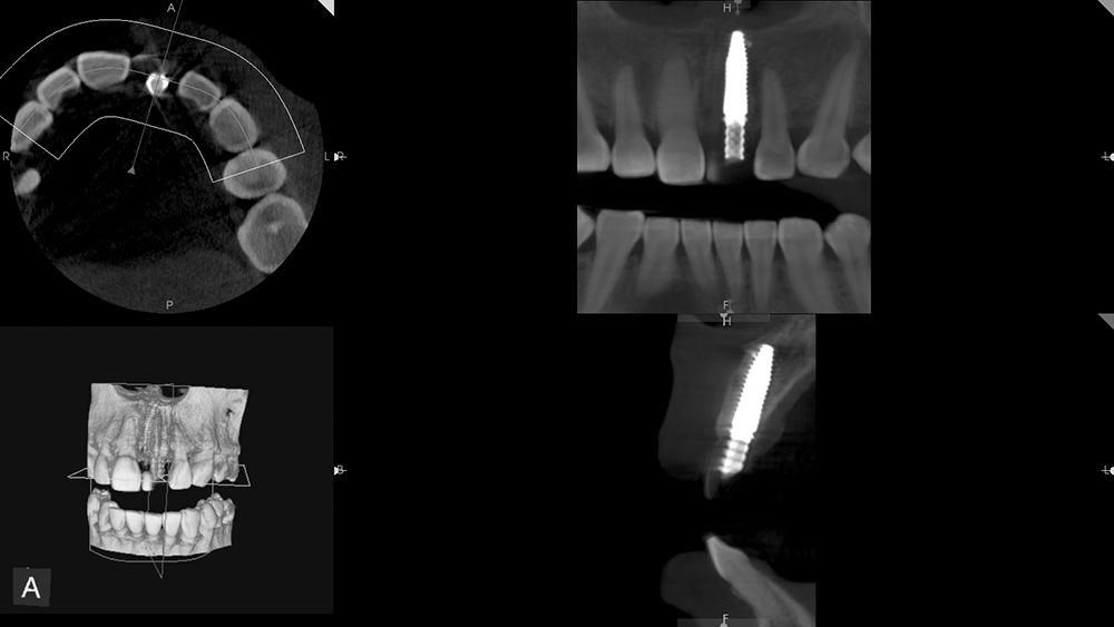Fig. 8b