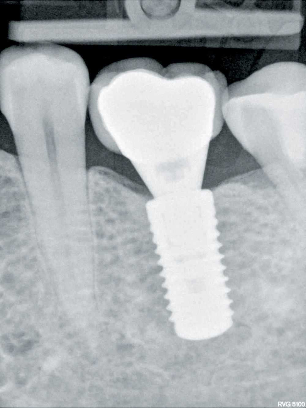 fig. 14