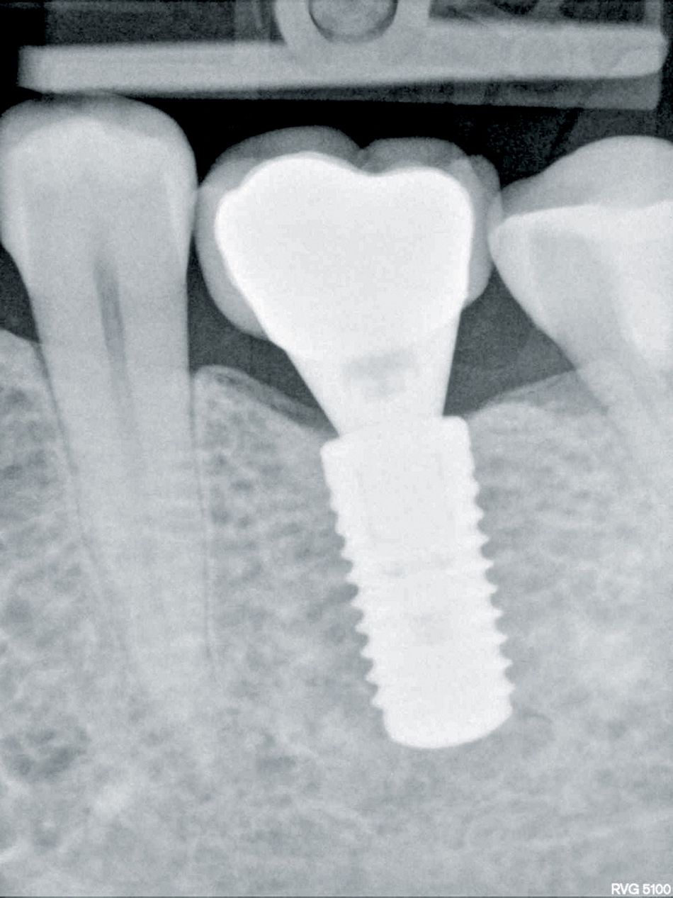 fig. 14