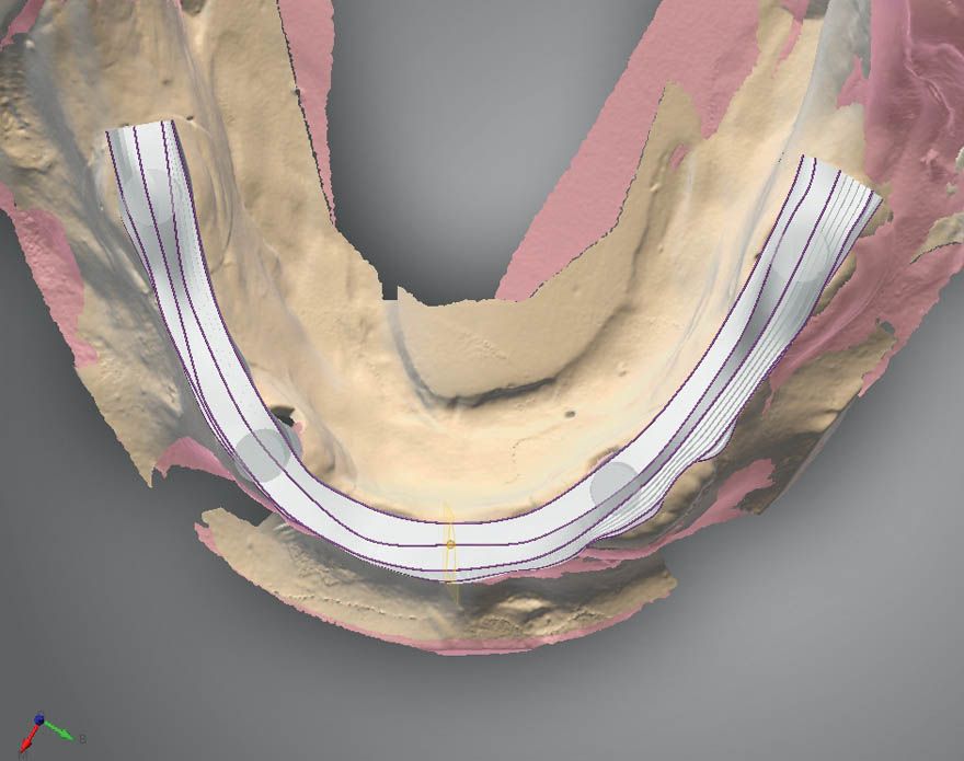 fig. 13