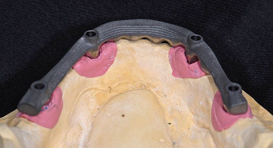 fig. 15