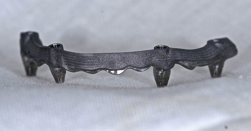 fig. 16