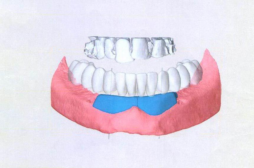fig. 5