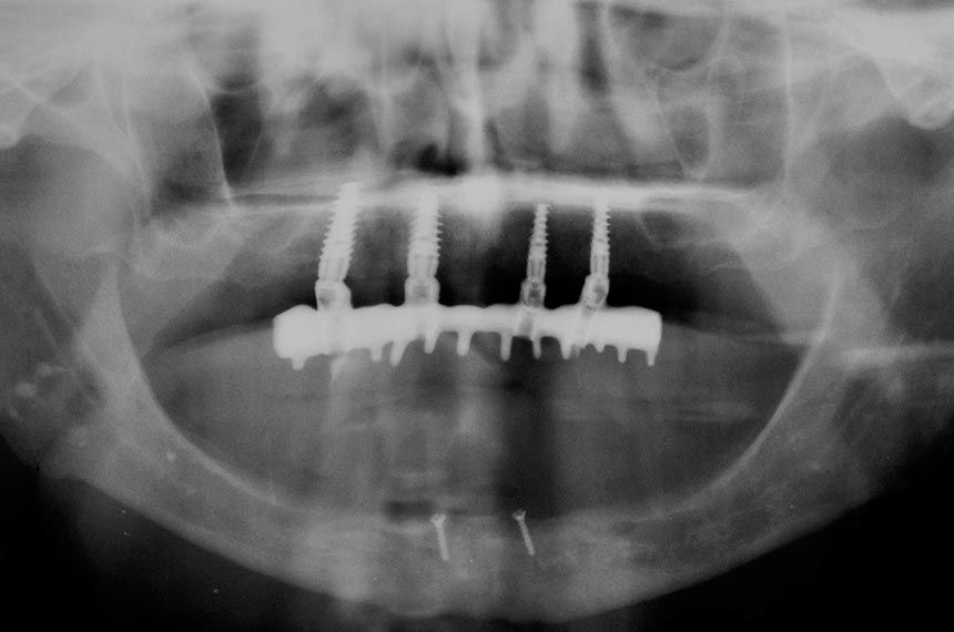fig. 11