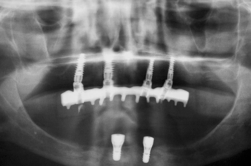 fig. 12