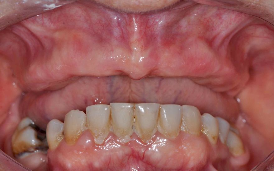 fig. 2a