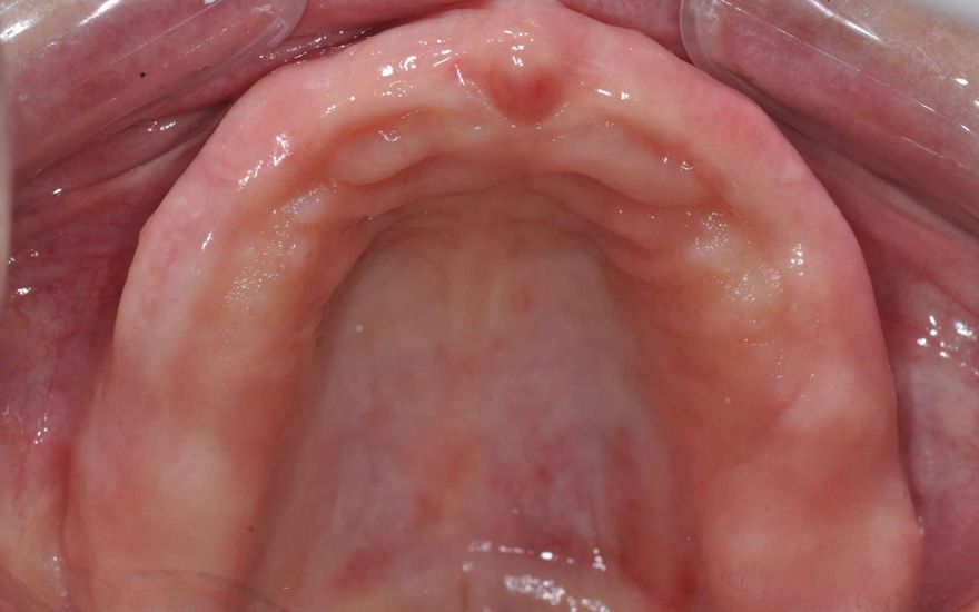 fig. 2b