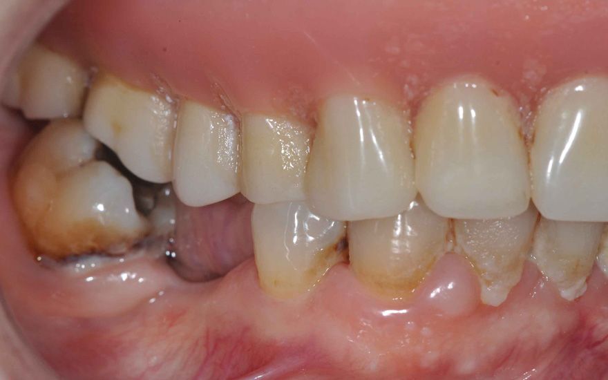 fig. 2e
