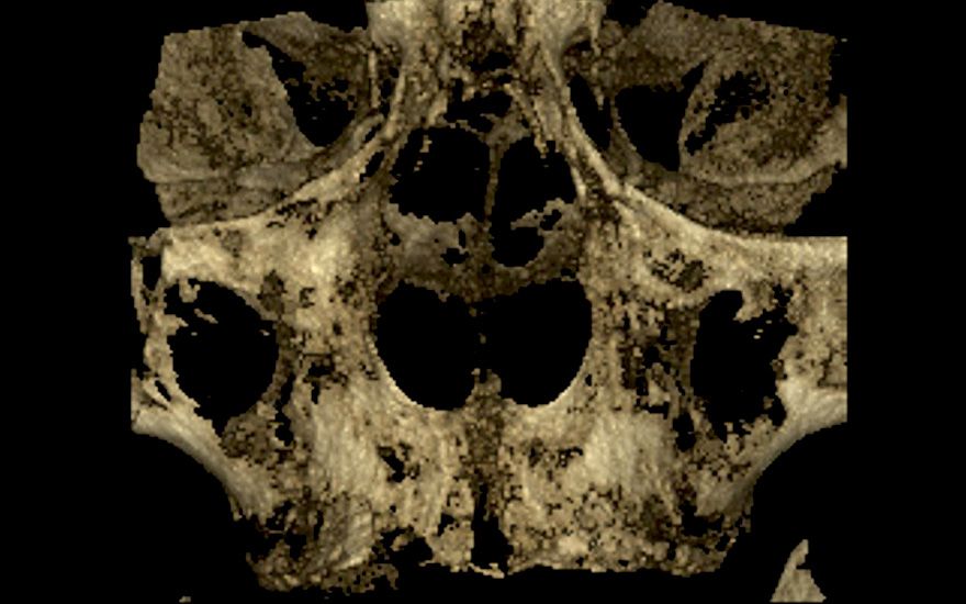 fig. 4a