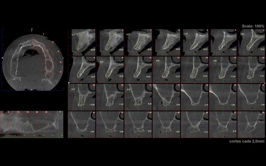 fig. 4b