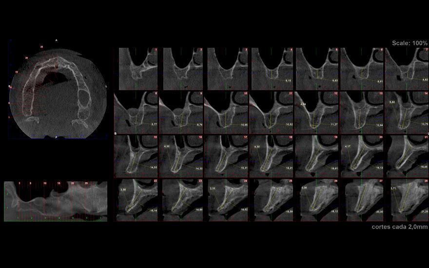 fig. 4c