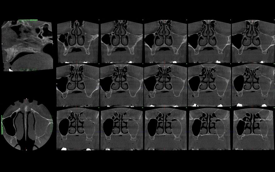 fig. 4d