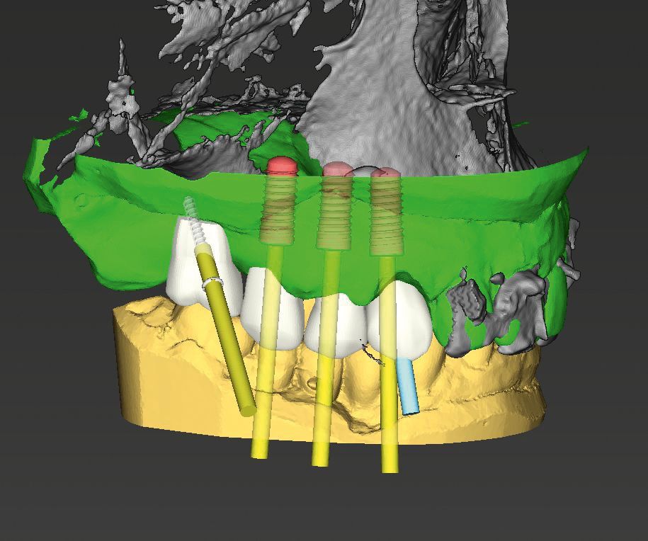 fig. 4