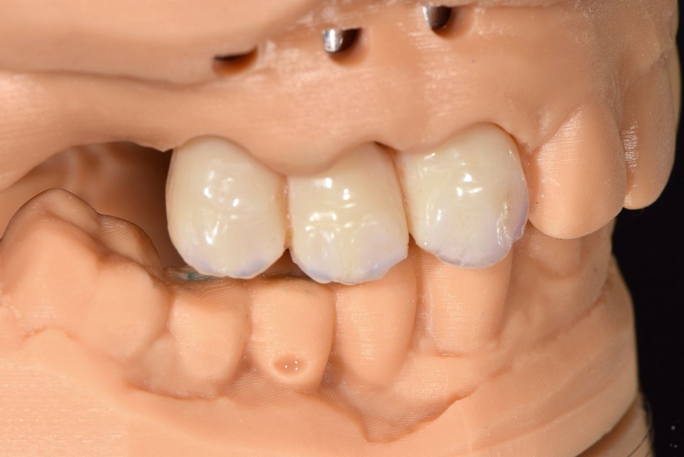 fig. 11