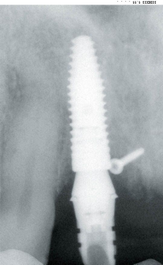 fig. 15