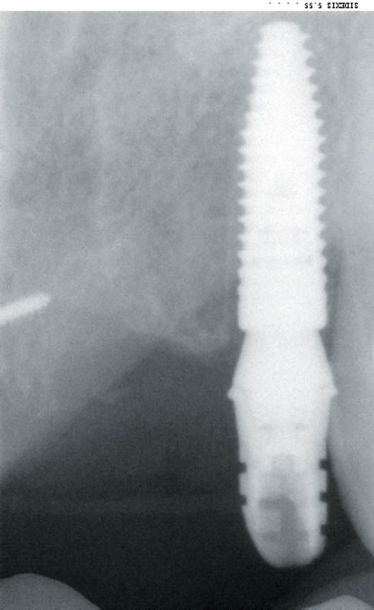 fig. 16