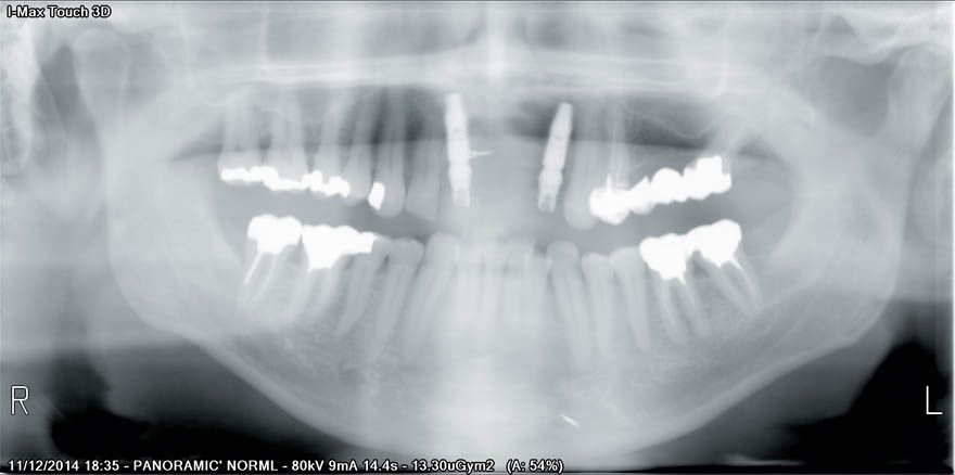 fig. 19