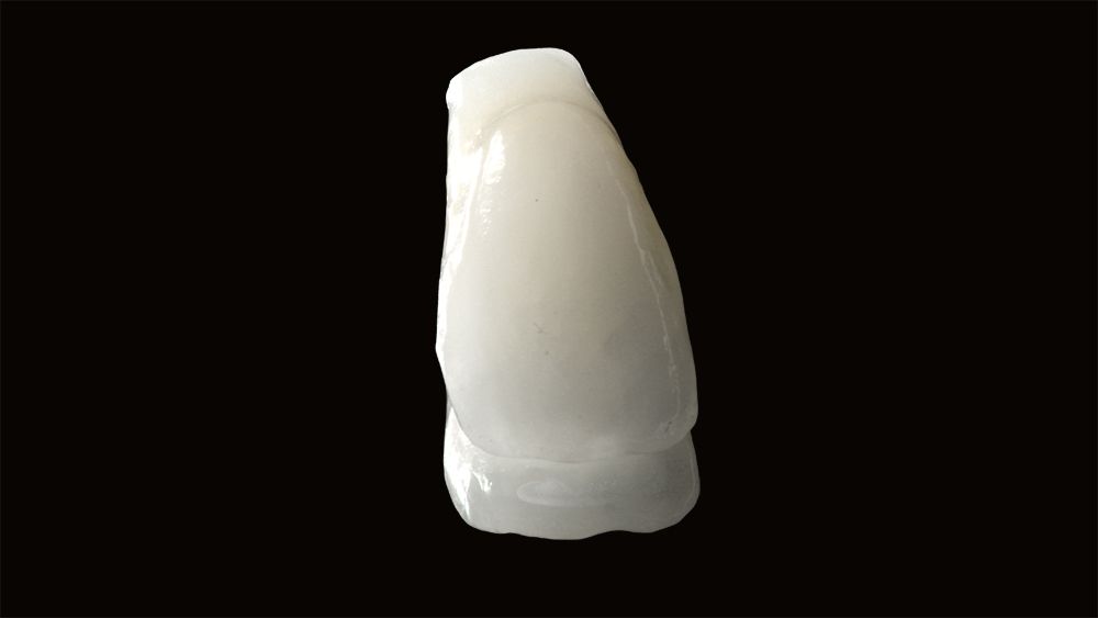 fig. 11