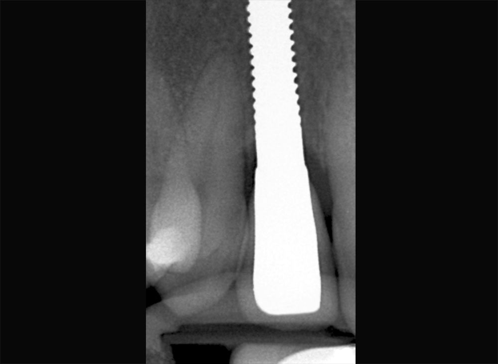 fig. 12