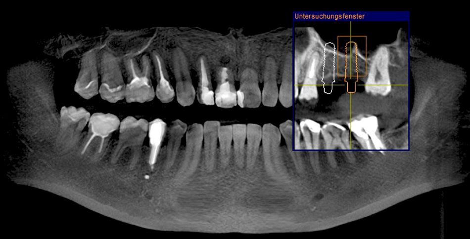 fig. 11