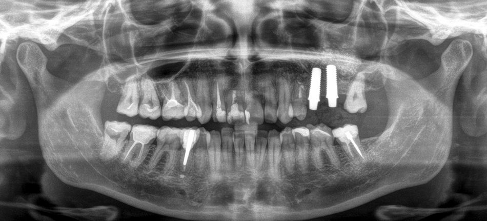 fig. 15