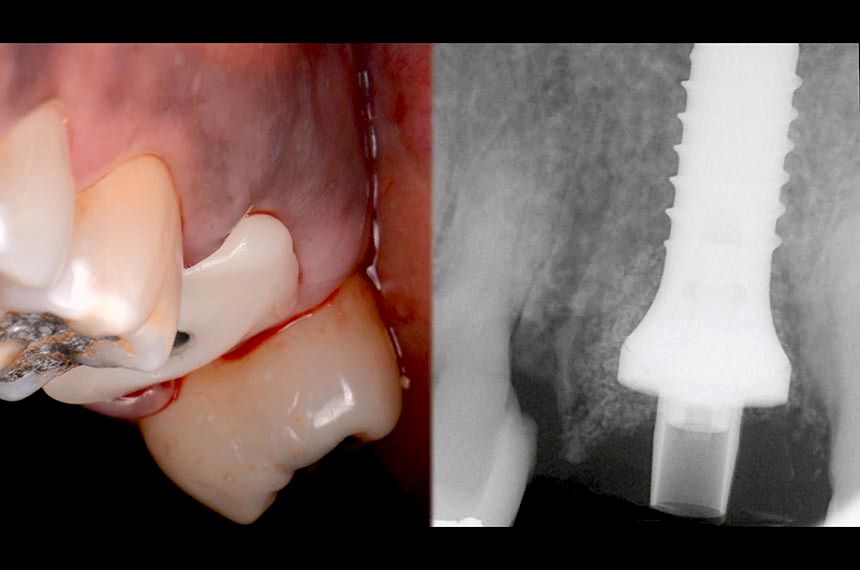 fig. 11