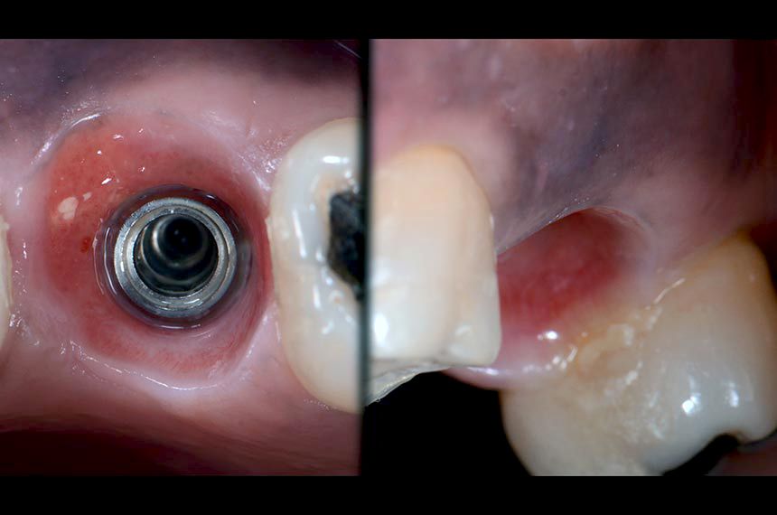 fig. 14
