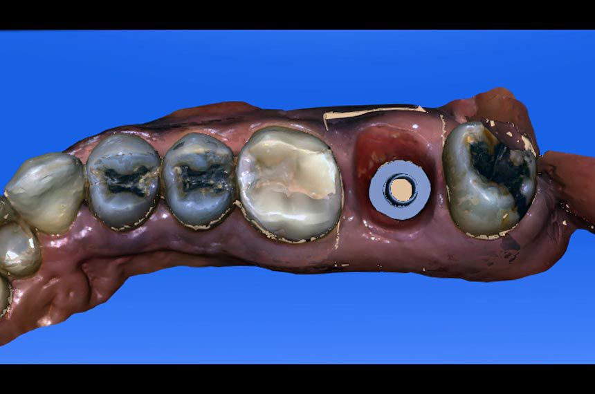 fig. 15
