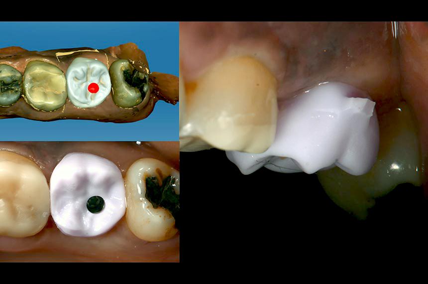 fig. 16
