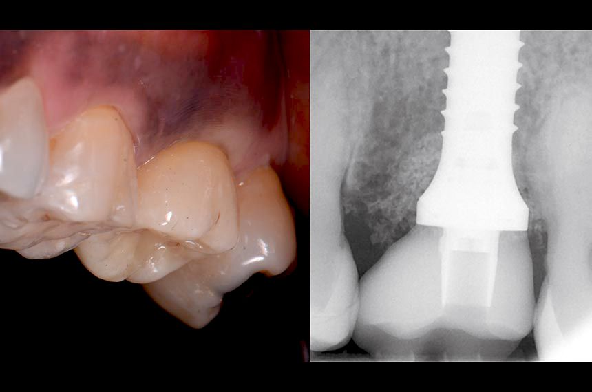 fig. 19