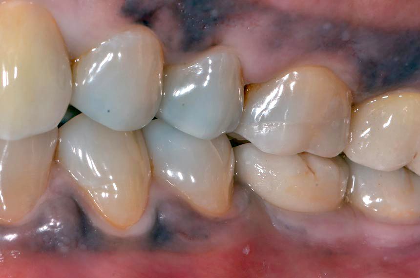 fig. 21