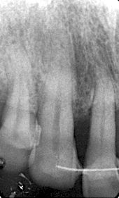 fig. 5b
