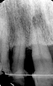 fig. 5c