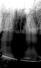 fig. 5d