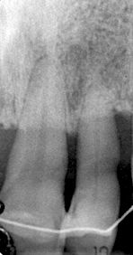 fig. 5e