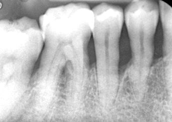 fig. 5i