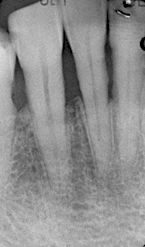 fig. 5j